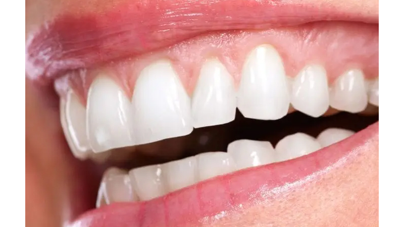 What is gum recession, its causes, preventive measure, sign to diagnose and its treatment.