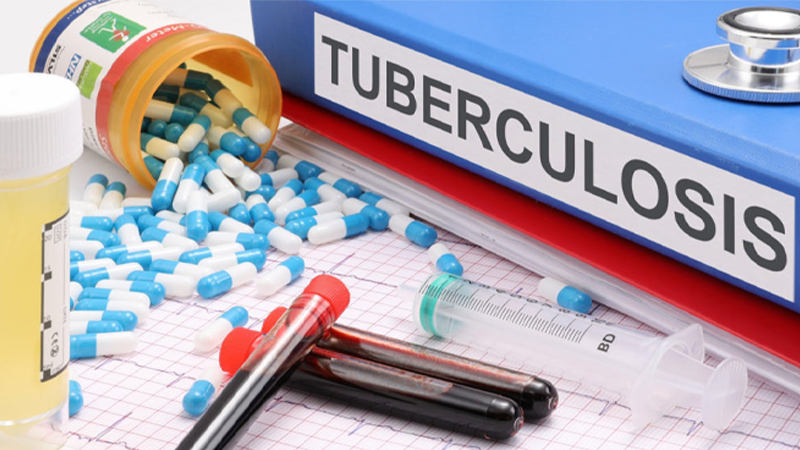 What-is-Tuberculosis-TB-its-Spread-Prevention-Symptoms-Causes-and-Type-of-Tuberculosis.