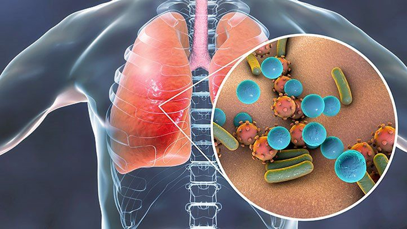  What-is-Tuberculosis-TB-its-Spread-Prevention-Symptoms-Causes-and-Type-of-Tuberculosis